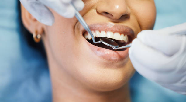 Best Emergency Dental Care for Sports Injuries in Ottawa, OH