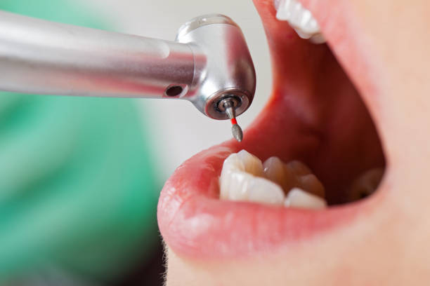 Best Emergency Treatment for Oral Infections in Ottawa, OH